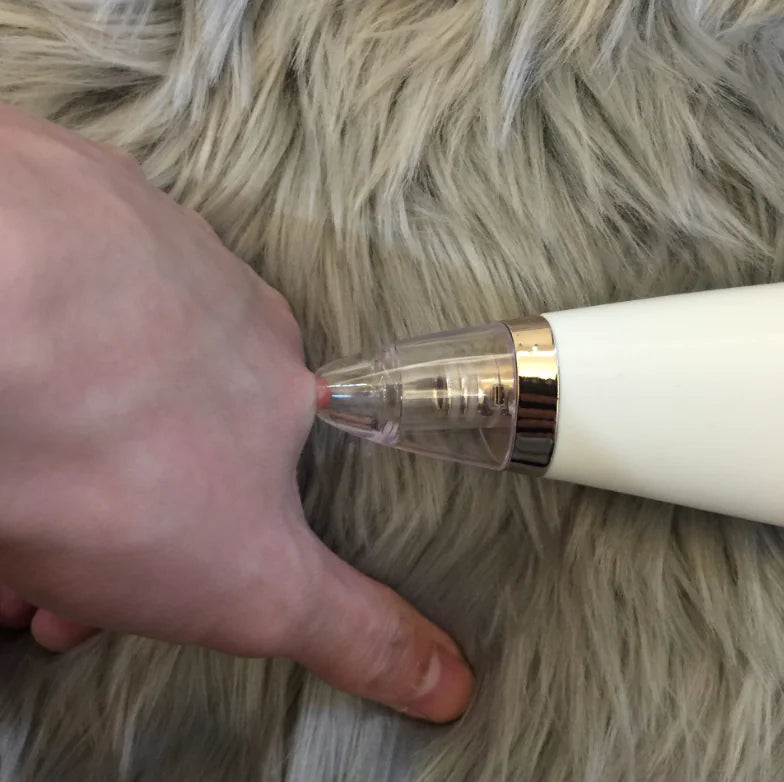 Pore Perfection Skincare Tool